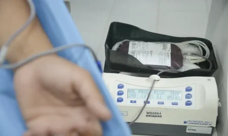 O Ministério da Saúde aprovou critérios para o uso de emicizumabe em crianças de até 6 anos com hemofilia A.