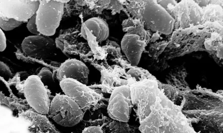 Yersinia pestis (Foto: NIAID/NIH/Wikimedia Commons — Domínio Público/Divulgação)