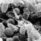 Yersinia pestis (Foto: NIAID/NIH/Wikimedia Commons — Domínio Público/Divulgação)