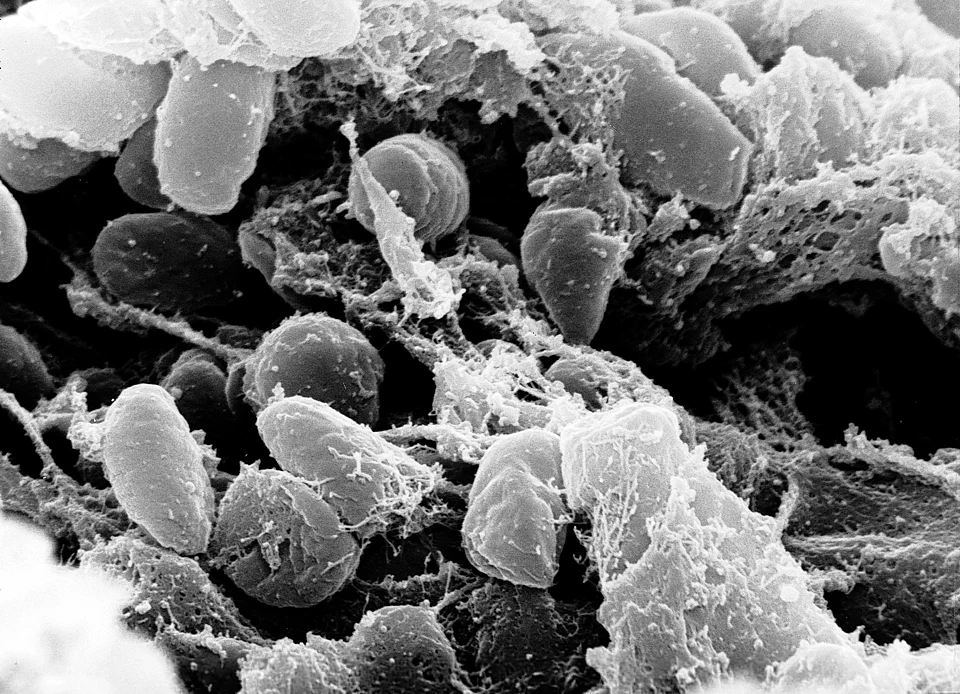 Yersinia pestis (Foto: NIAID/NIH/Wikimedia Commons — Domínio Público/Divulgação)